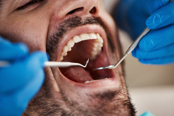 Best Dentist for Tooth Abscess  in Elsa, TX