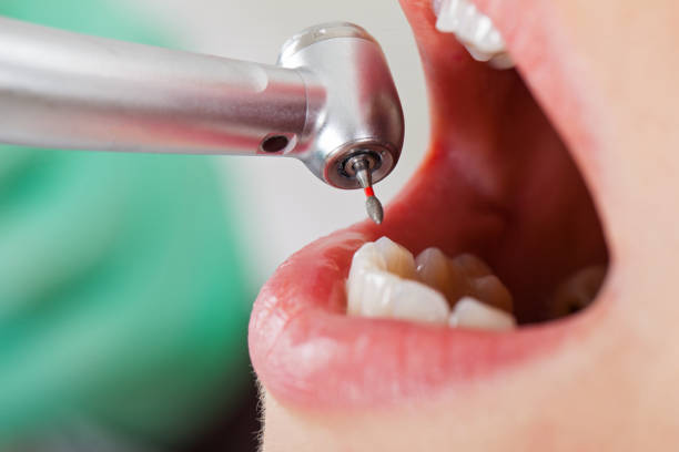 Best Broken Tooth Emergency  in Elsa, TX